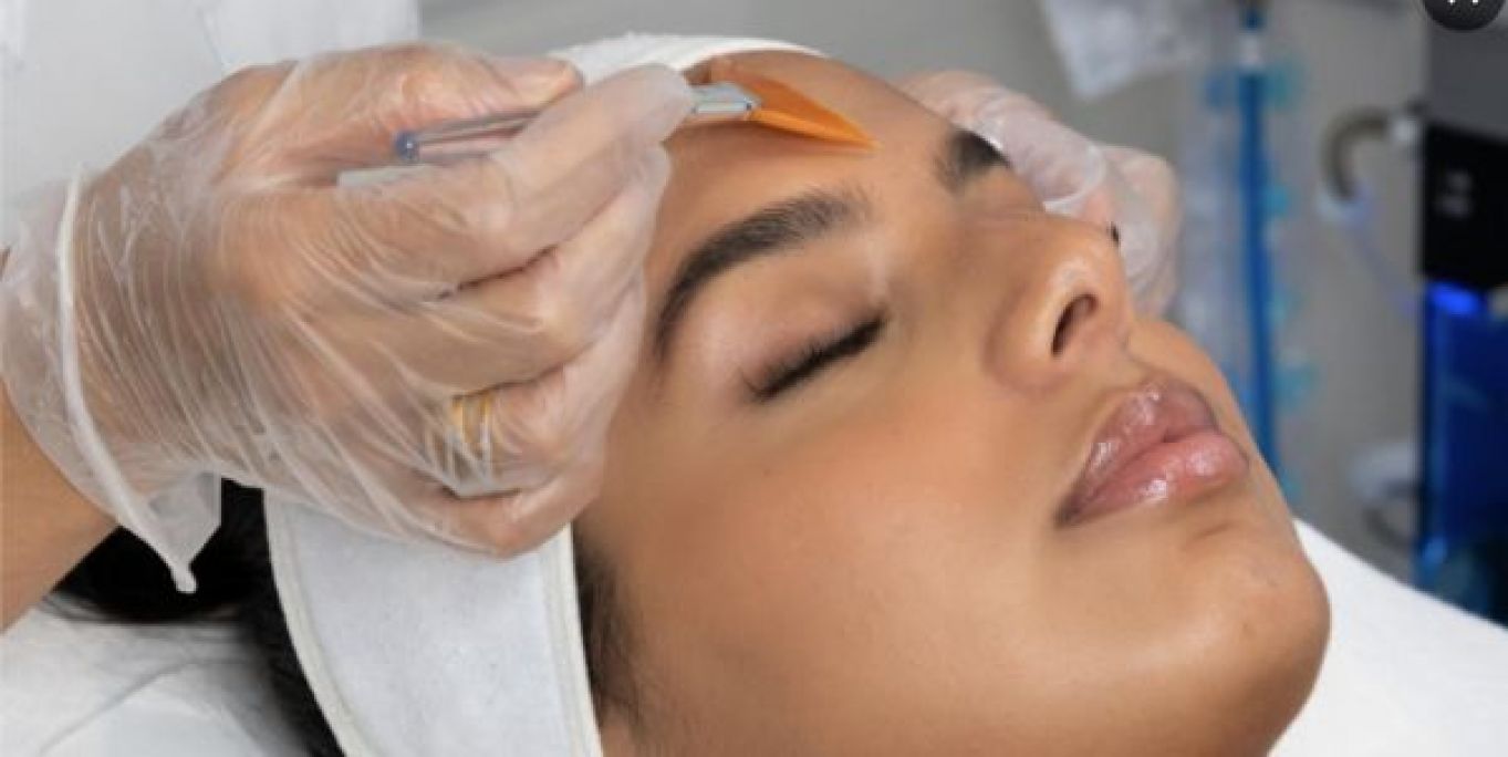 Peeling à Bagneux (92) Par Myriame - Estheca