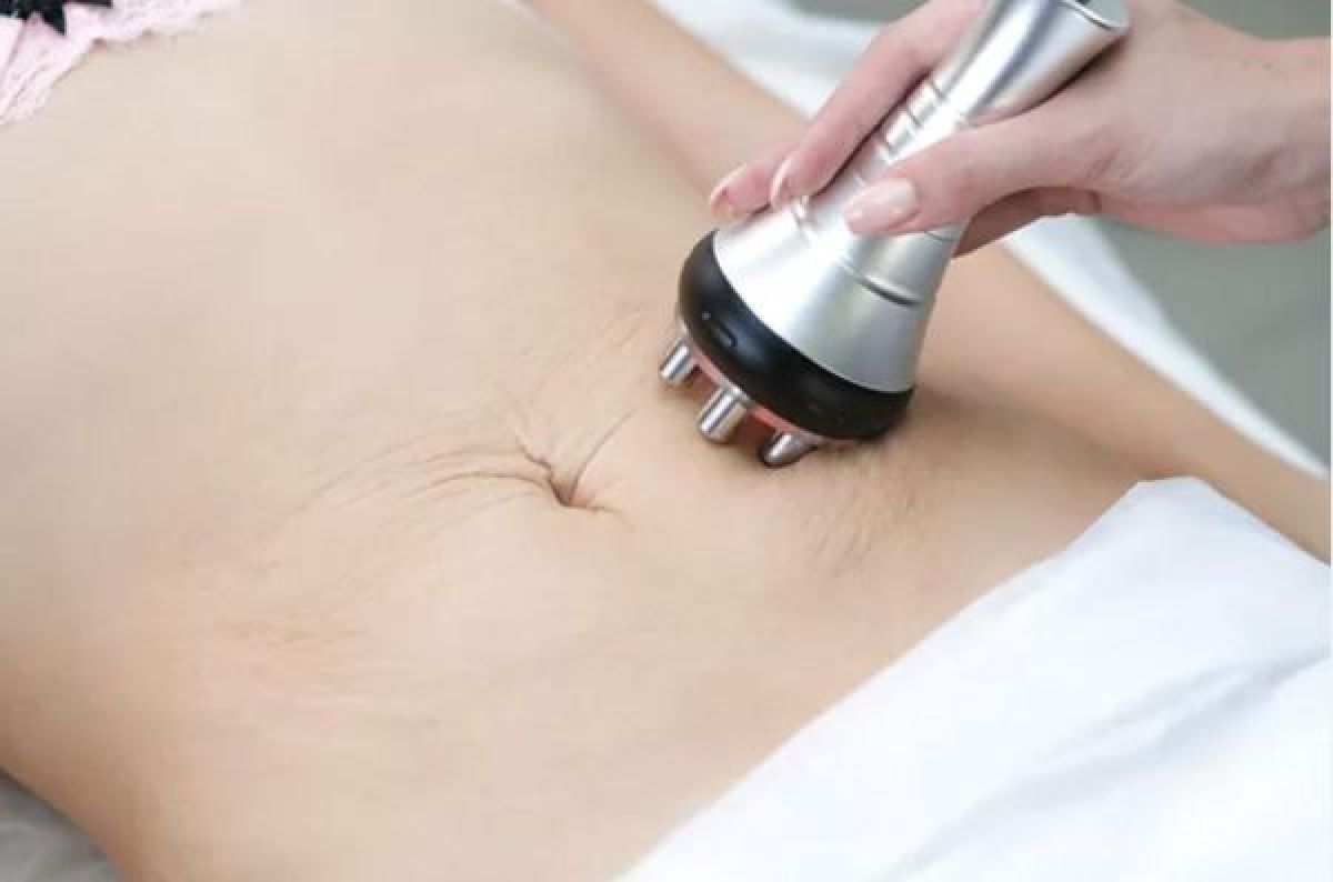 Radiofréquence / Lipocavitation / Lipolaser à Ulis (91) Par Nina - Estheca