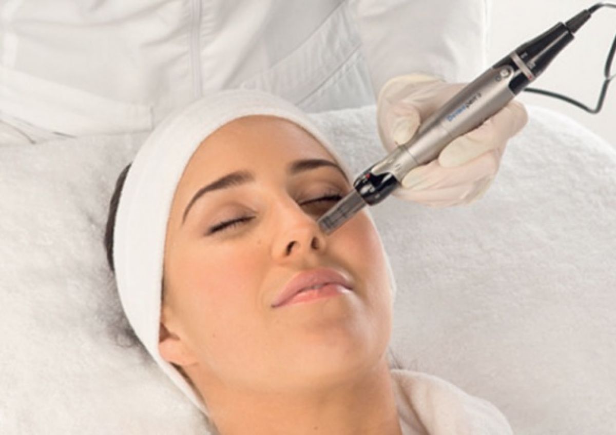 Microneedling à Paris (75) Par Naya - Estheca