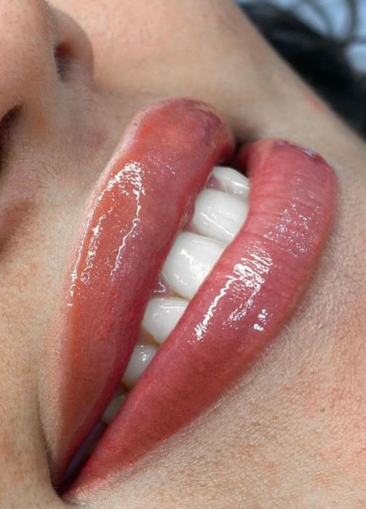 Candy Lips ( pigmentation des lèvres ) à Saint-Cyr-sur-Morin (77) Par Mariana - Estheca