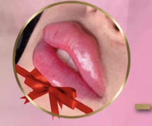 À Montpellier | Formation Russian Lips | Les meilleures esthéticiennes