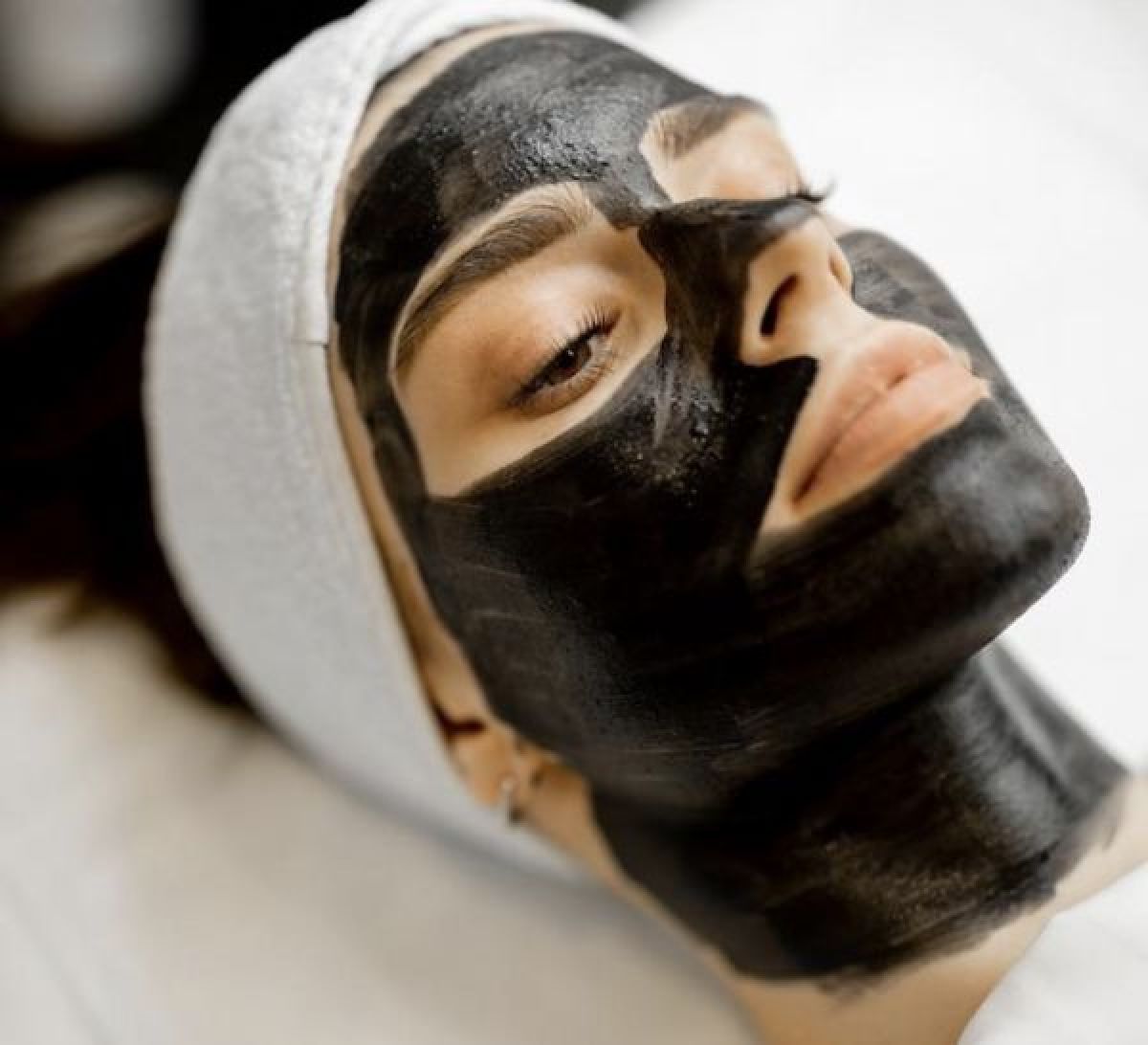 Carbon peel à Marseille (13) Par Julie - Estheca