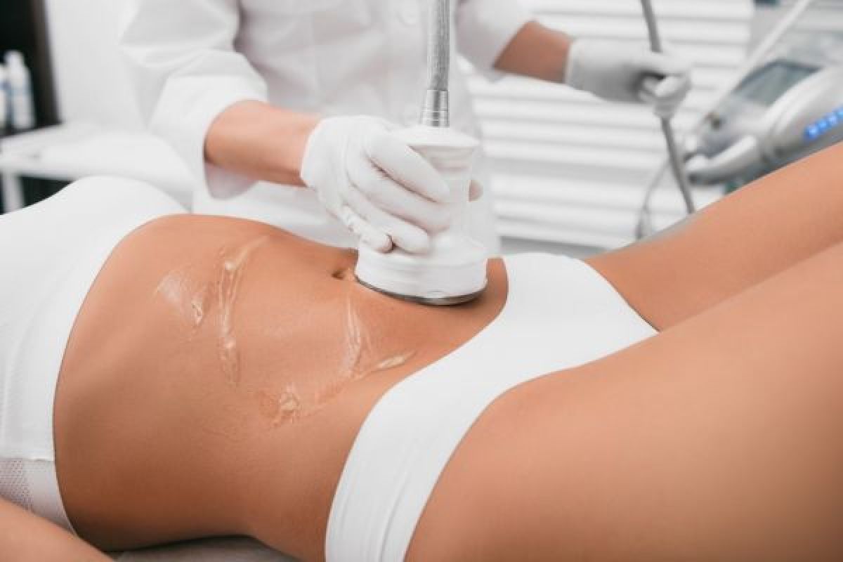 Lipocavitation à Sens (89) Par Aurélie - Estheca