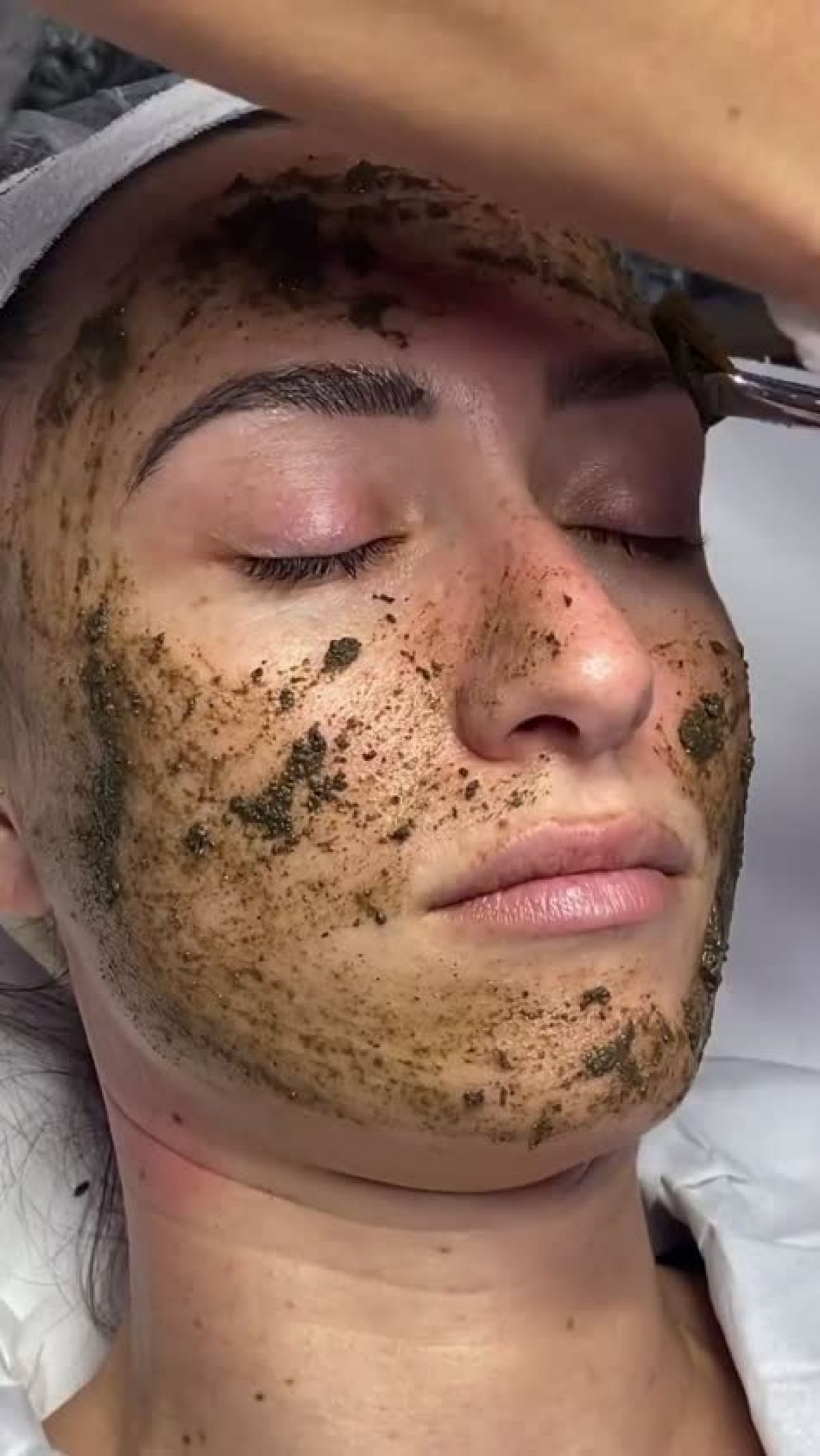 Peeling Aux Algues 80% Exfoliant - 2g - Anti-imperfections Et Cicatrices - Neuf