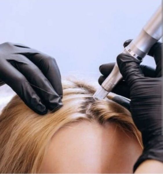 À Bezouce | Hairneedling | Les meilleures esthéticiennes