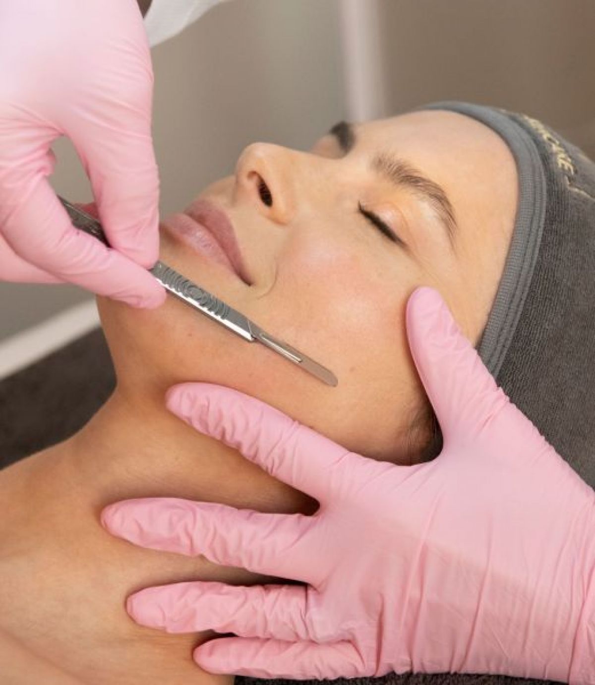 Dermaplaning à Villeurbanne (69) Par Zahidé - Estheca