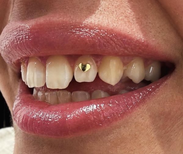 À Saint-Jean-de-Védas | Strass dentaire Swarovski | Les meilleures esthéticiennes