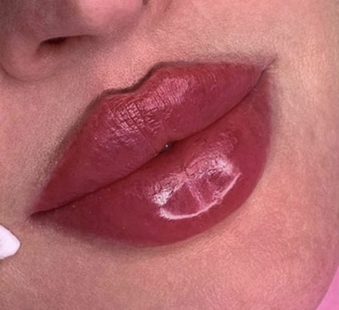 À Nice | Russian lips /  Jawline/Cernes/Pommettes | Les meilleures esthéticiennes