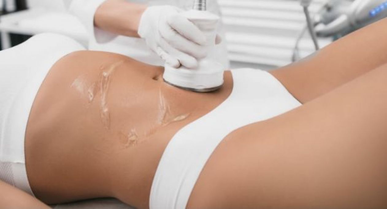 Formation Lipocavitation/Radiofréquence/Lipolaser à Rennes (35) Par Kloe - Estheca