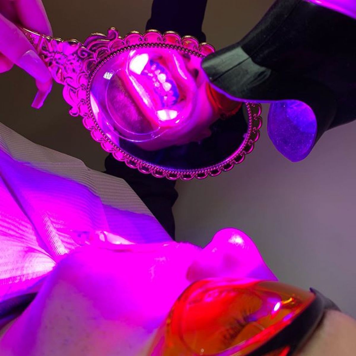Blanchiment dentaire Professionnel à Bègles (33) Par Pauline - Estheca