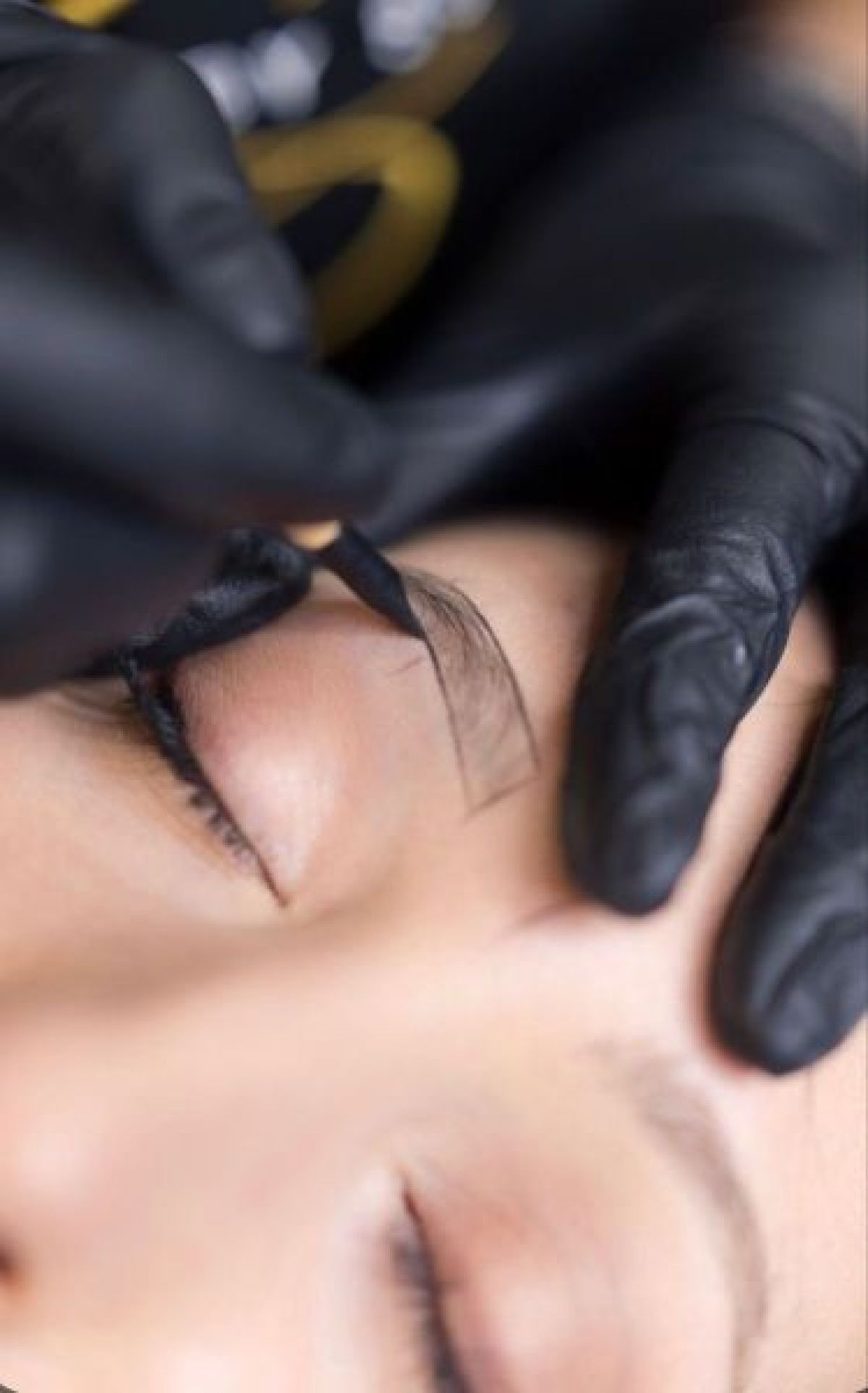 Microshading  à Fréjus (83) Par Julie - Estheca
