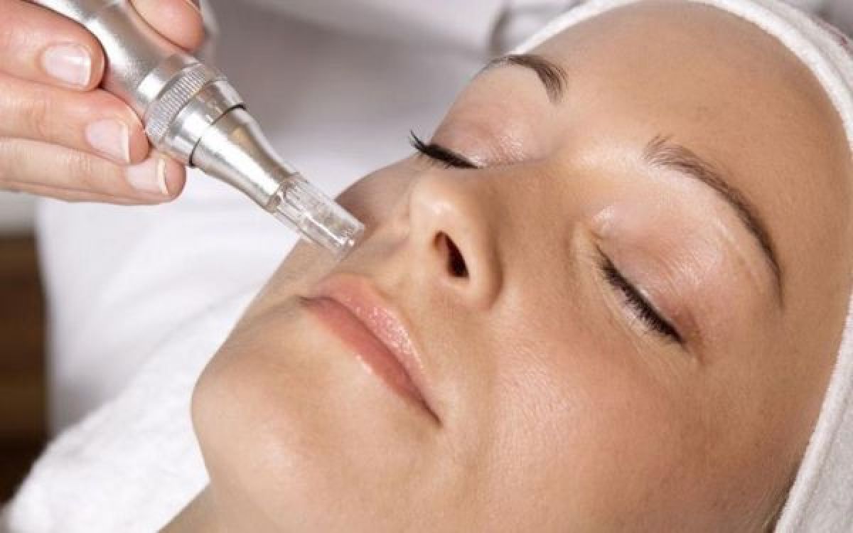 Microneedling bb-glow (traces d'acné, imperfections...) à Thiais (94) Par Alexandra - Estheca