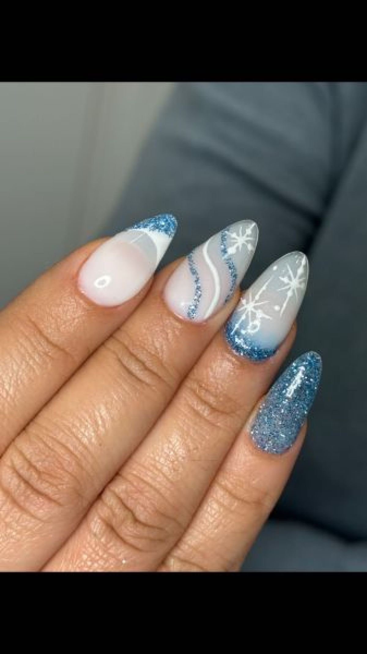 Pose de capsule  américaine +VSP à Courbevoie (92) Par Fatoumata - Estheca