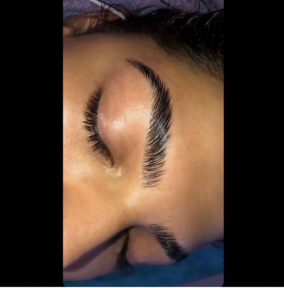 Brow lift à Lyon (69) Par Somia - Estheca