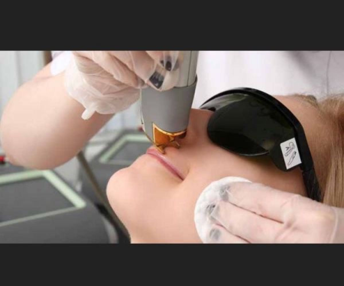 Epilation definitive à la lumière pulsée  à Lille (59) Par Elodie - Estheca