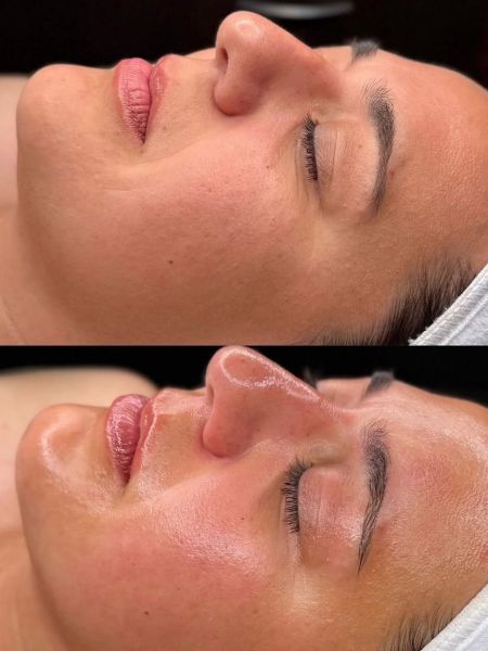 À Clamart | Hydrafacial / Soin visage | Les meilleures esthéticiennes