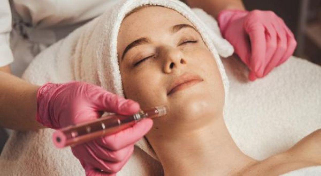 Microneedling / bb glow à Chilly-Mazarin (91) Par Liudmila - Estheca
