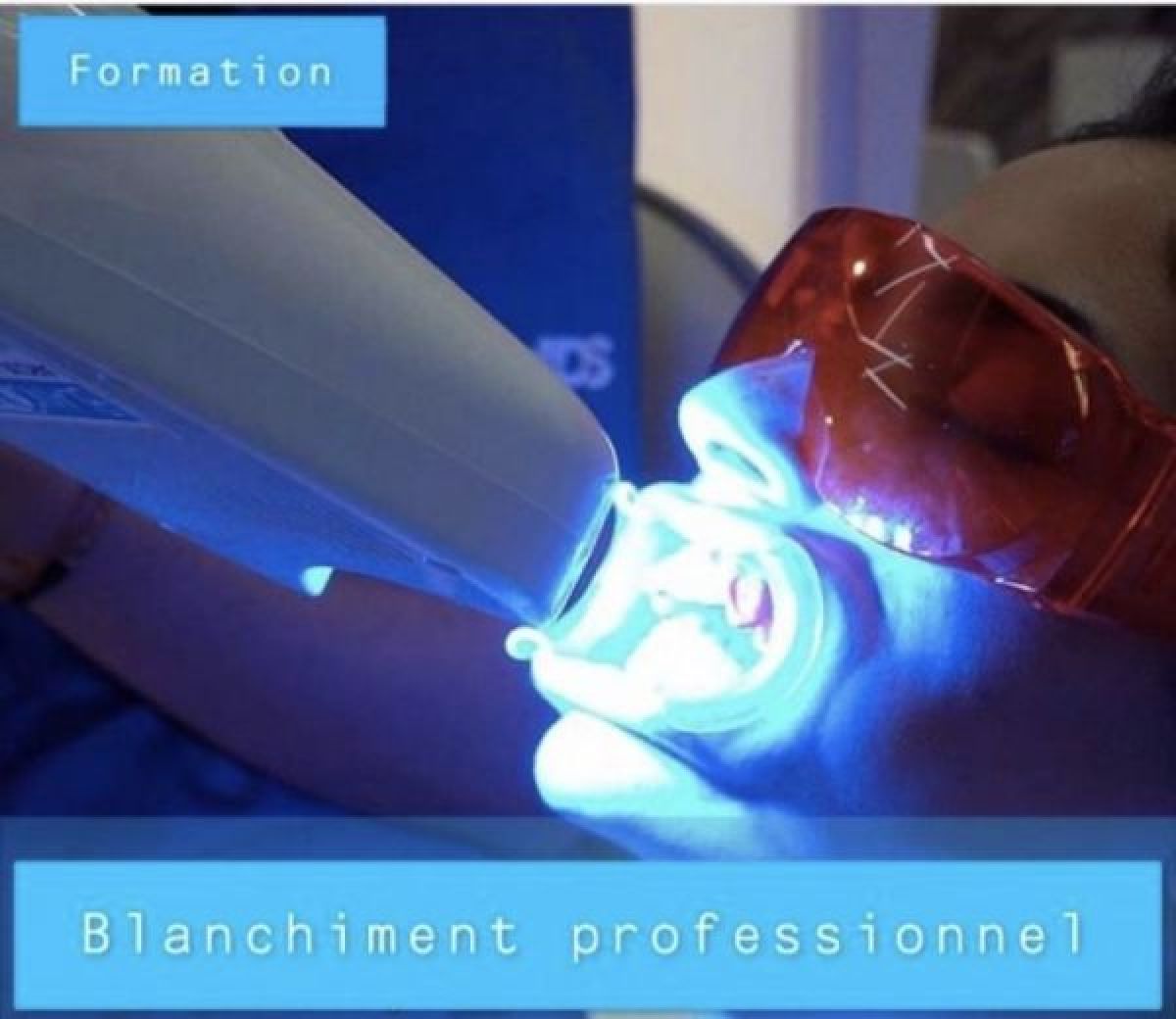 Formation blanchiment dentaire  à Montpellier (34) Par Nadia - Estheca