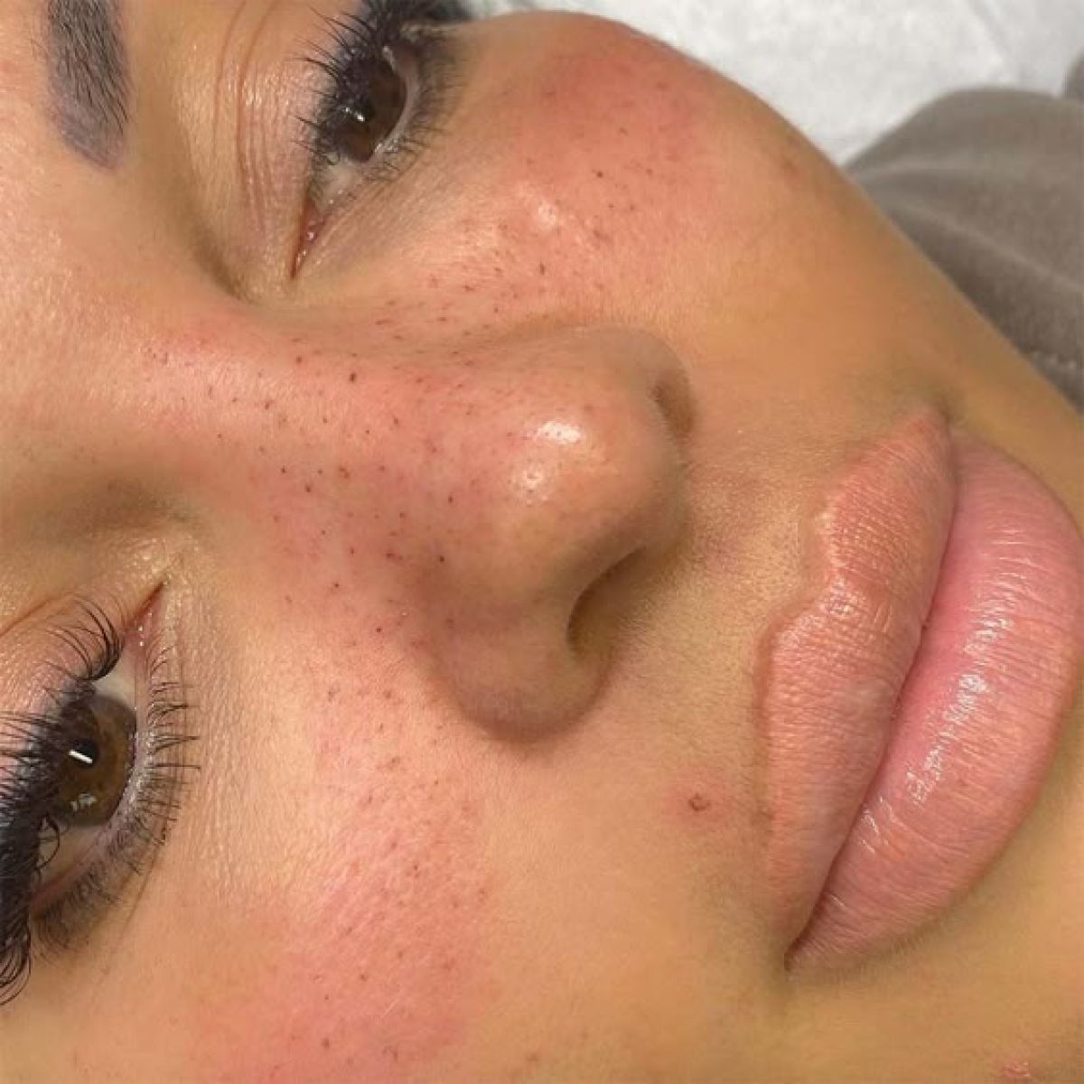 Formation taches de rousseur à Lagny-sur-Marne (77) Par Mary - Estheca