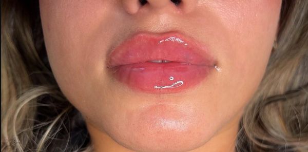 À Paris | Russian Lips / GLOW LIPS  | Les meilleures esthéticiennes
