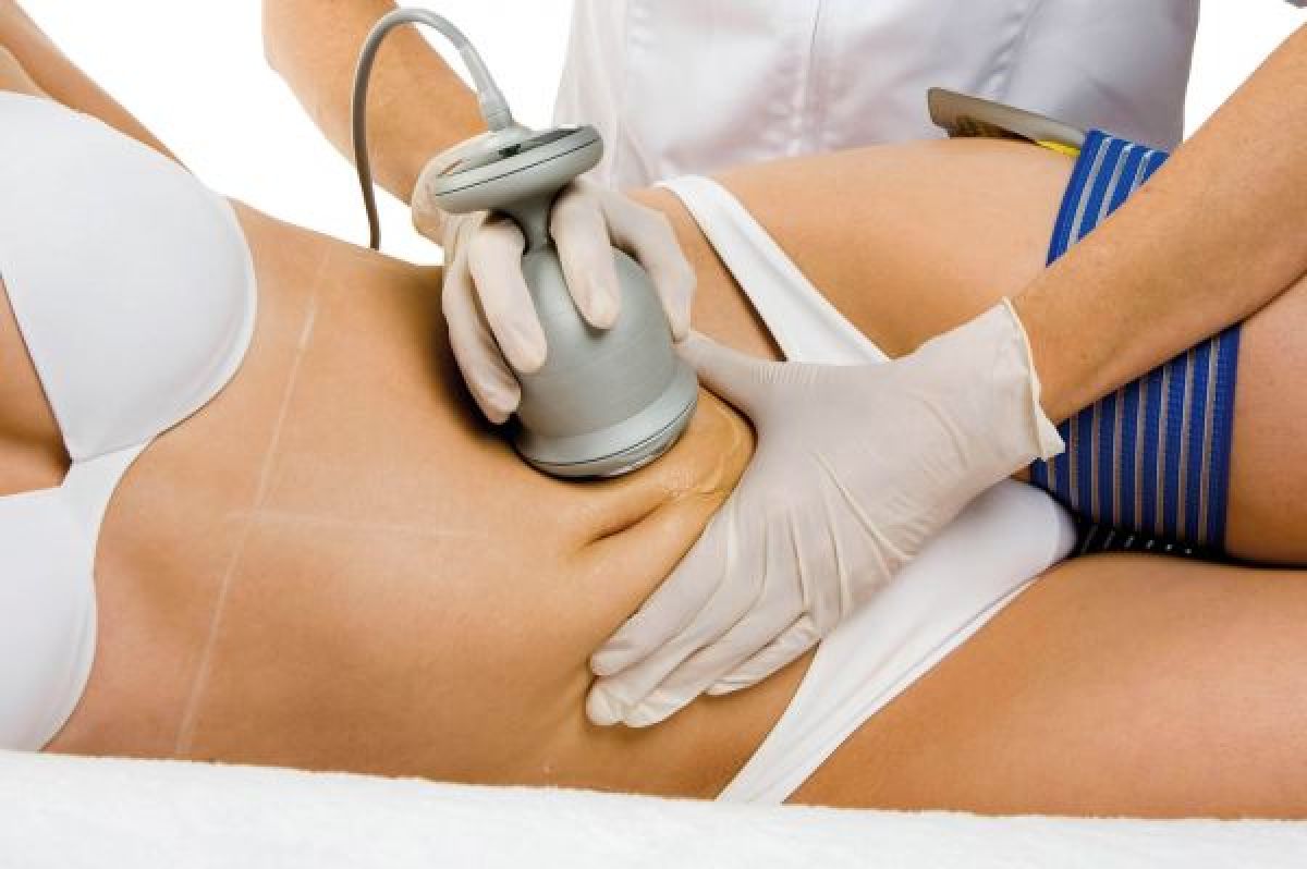 Radio fréquence / Lipocavitation à Hœnheim (67) Par Mylène - Estheca