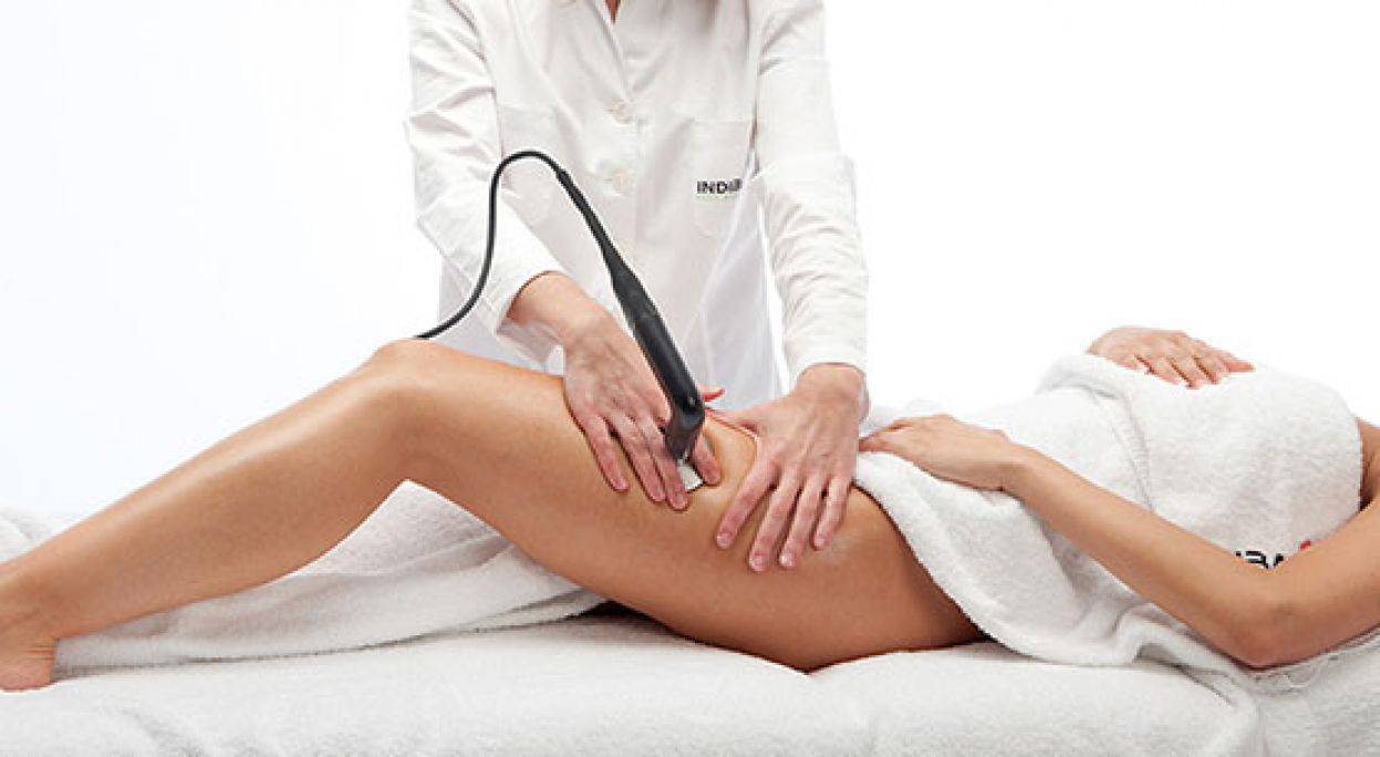 Radio fréquence / Lipocavitation à Colomiers (31) Par Mélanie - Estheca
