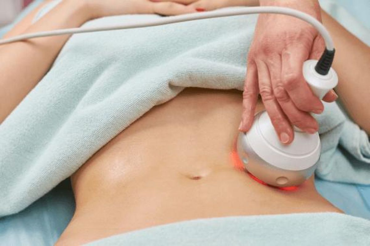 Radio fréquence et Lipocavitation à Chartres (28) Par Sandy - Estheca