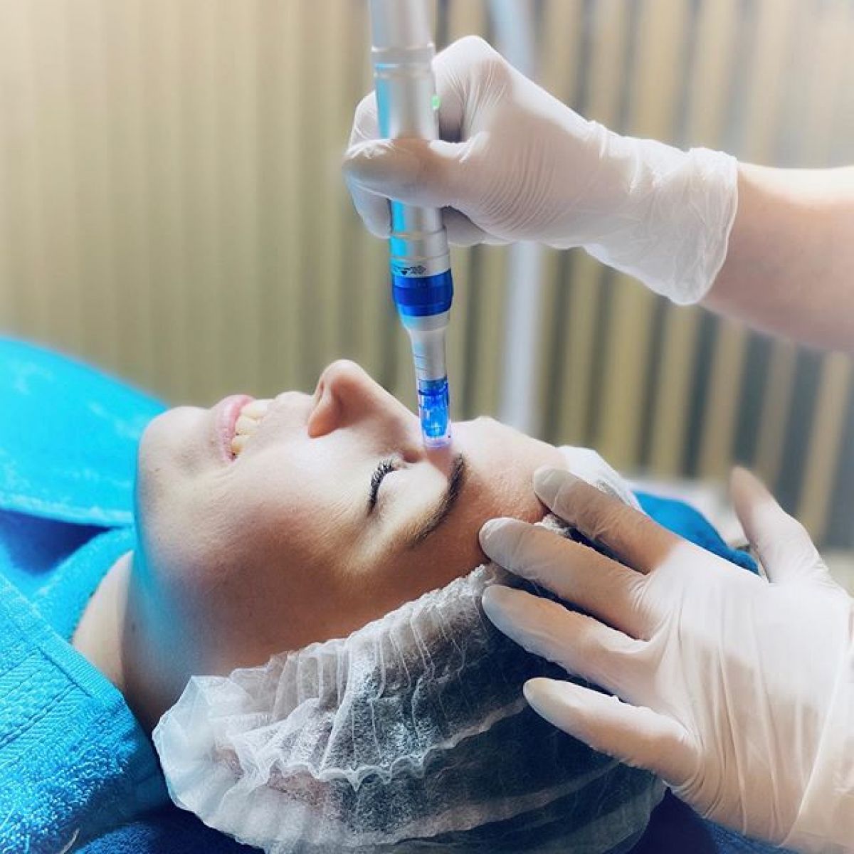 MicroNeedling BB Glow à Tiercé (49) Par Sabrina - Estheca