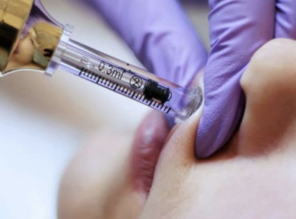 À Limoges | Hyaluron pen/Russian lips  | Les meilleures esthéticiennes