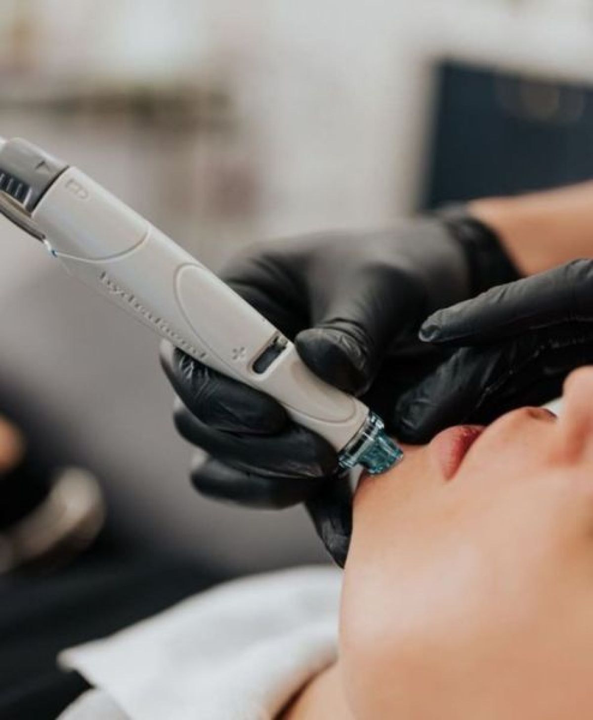 Hydraskin à Thionville (57) Par Kelly - Estheca