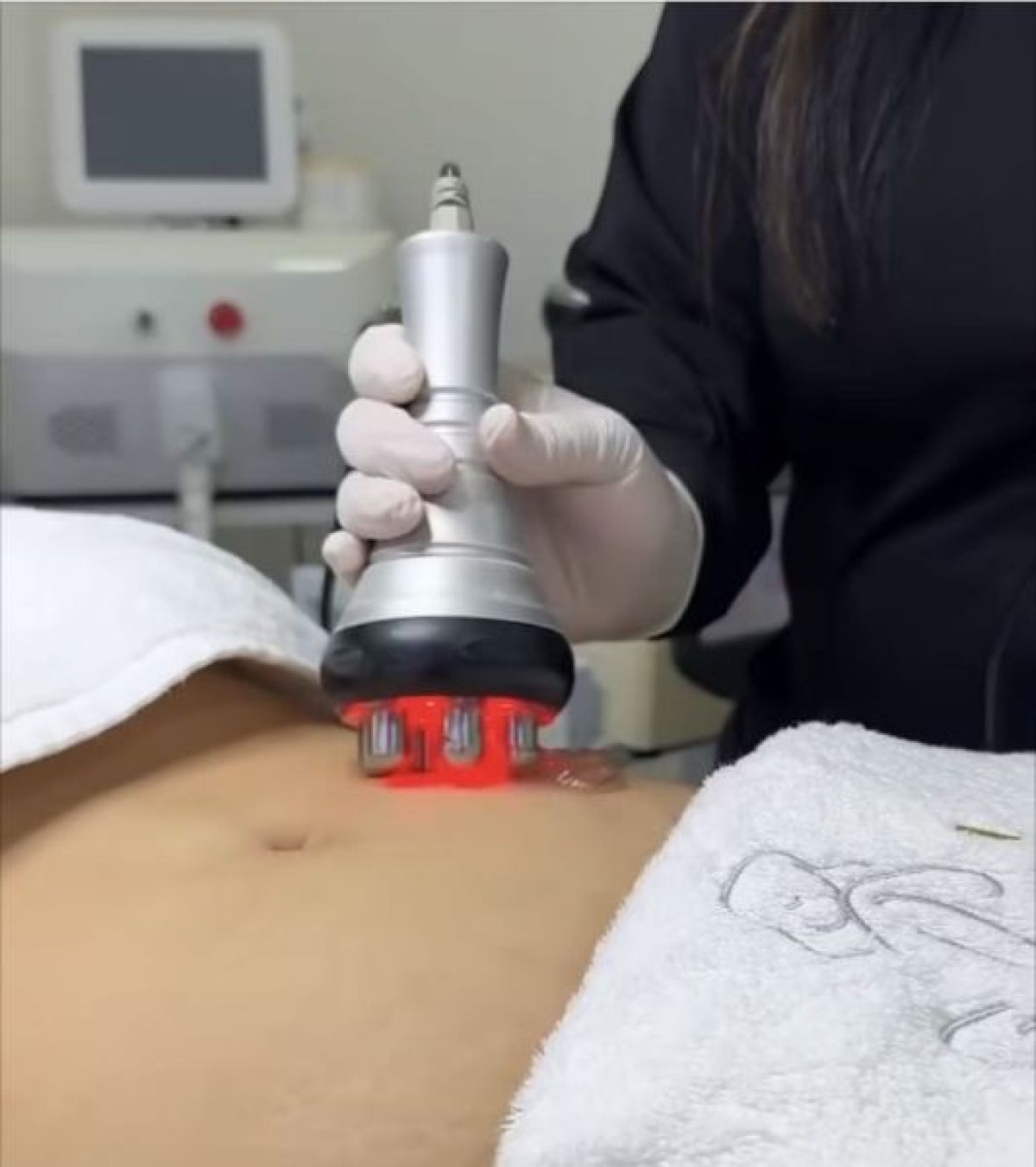 Radiofréquence / Lipo-Cavitation / Lipolaser / Vacuum à Meylan (38) Par Marine - Estheca