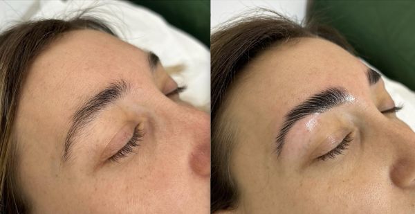 À Morières-lès-Avignon | Browlift (rehaussement de sourcils) | Les meilleures esthéticiennes