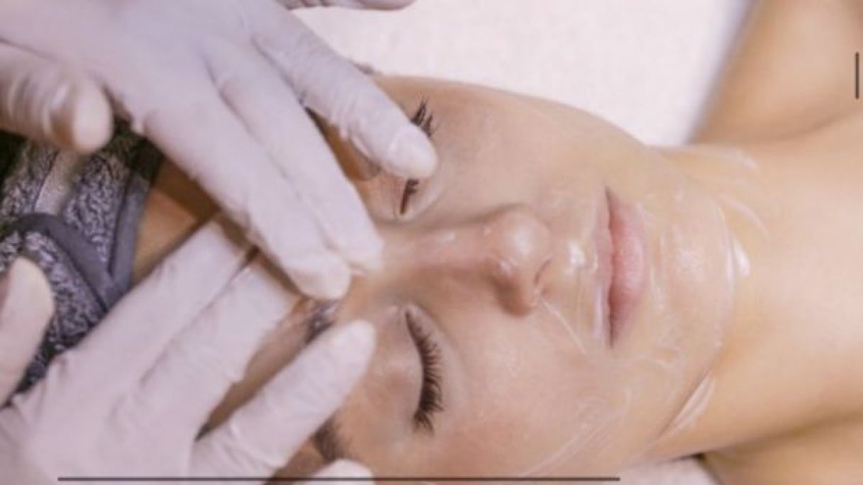 Peeling à Montigny-le-Bretonneux (78) Par Mélanie - Estheca