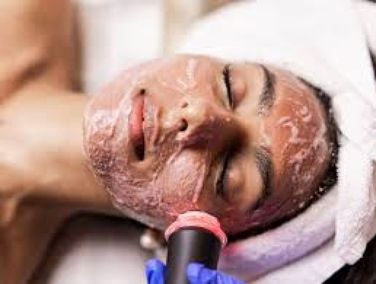 Soins OXY SKIN CLEAR à Saint-Maixent-l'École (79) Par Rhizlene - Estheca