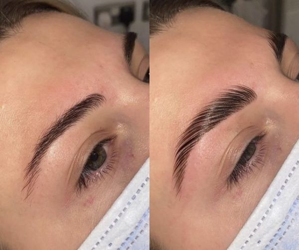 À Strasbourg | Browlift (rehaussement de sourcils)  | Les meilleures esthéticiennes