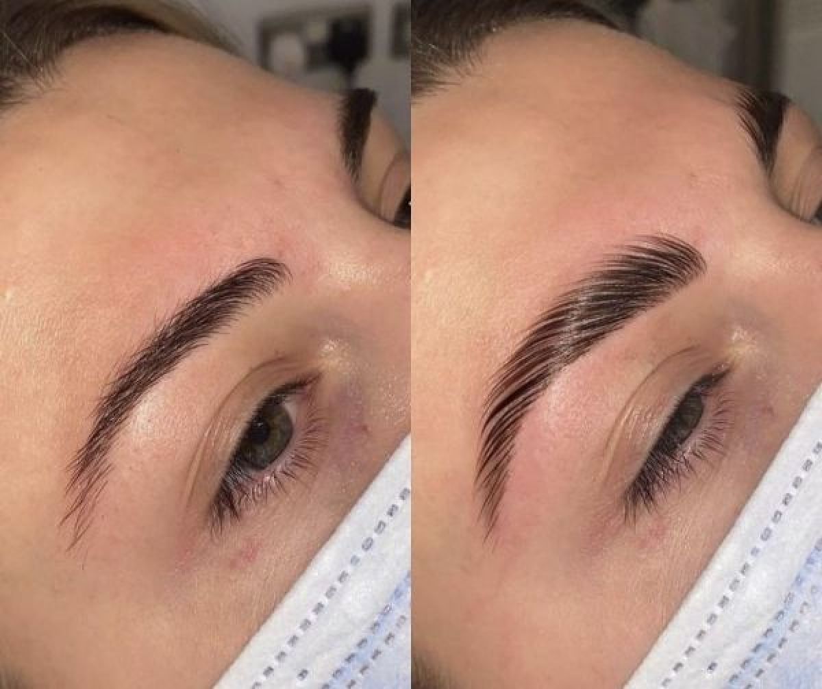 Browlift (rehaussement de sourcils)  à Strasbourg (67) Par Noura - Estheca