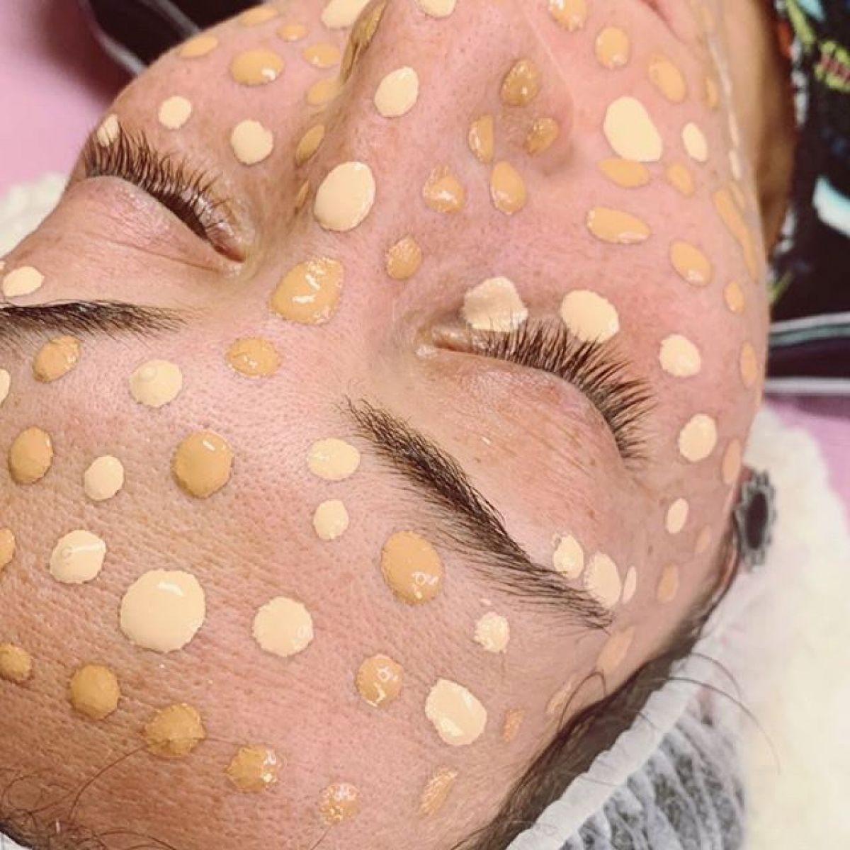 MicroNeedling BB Glow à Toulouse (31) Par Marina - Estheca