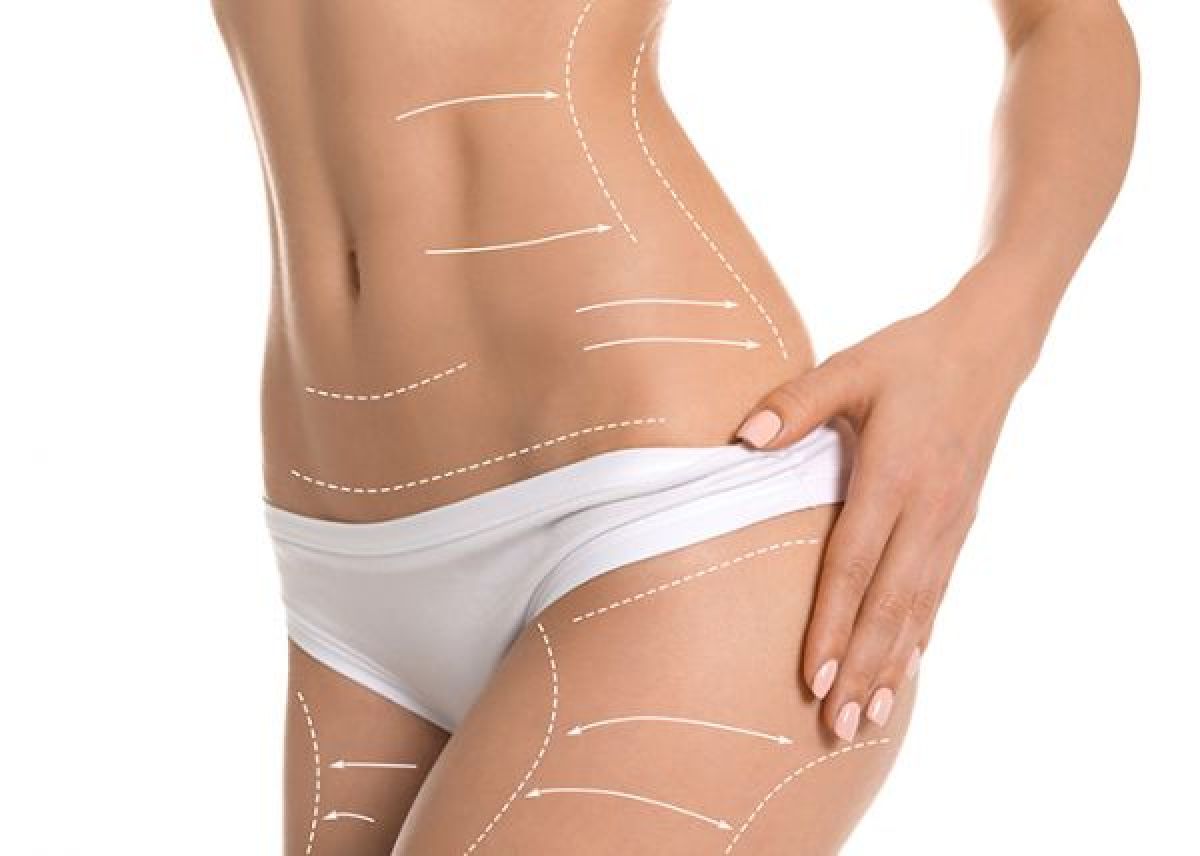 Remodelage minceur brésilien à Vétheuil (95) Par Jennifer - Estheca