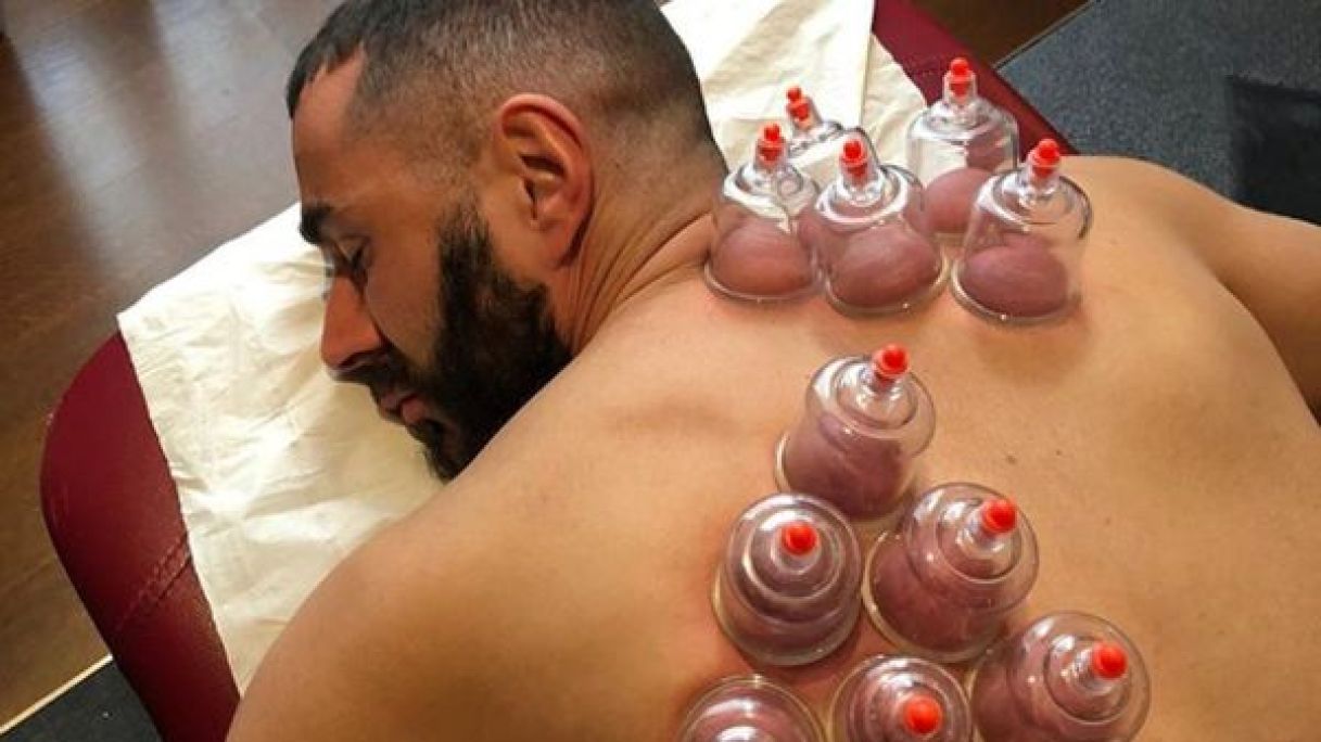 Ventouse chinoise à Lillers (62) Par Leonie - Estheca