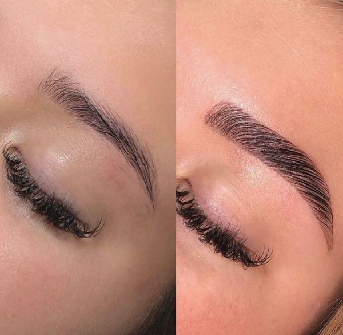 Browlift (rehaussement de sourcils) à Nogent-sur-Oise (60) Par Elif - Estheca