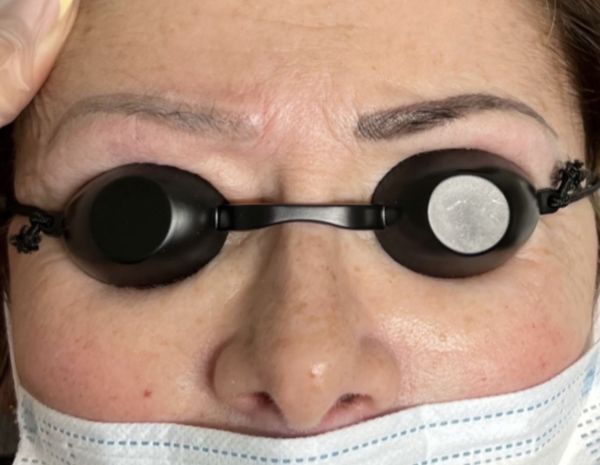 À Aulnay-sous-Bois | Détatouage | Les meilleures esthéticiennes