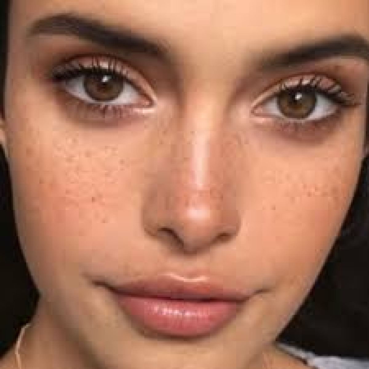 Taches de rousseur / Grain de beauté à Noyal-sur-Vilaine (35) Par Coralie - Estheca