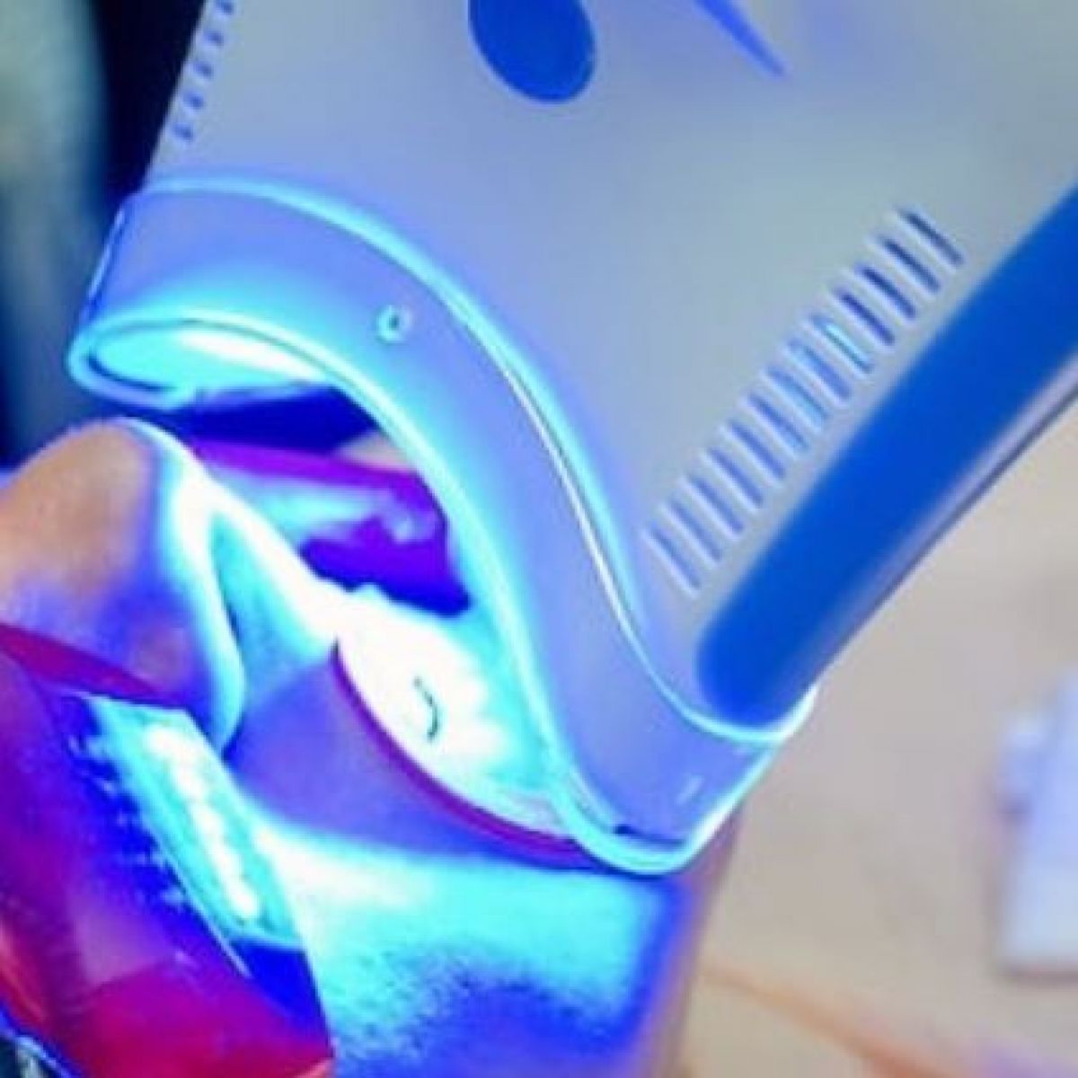 Blanchiment dentaire à Saint-Paul-lès-Dax (40) Par Mélanie - Estheca