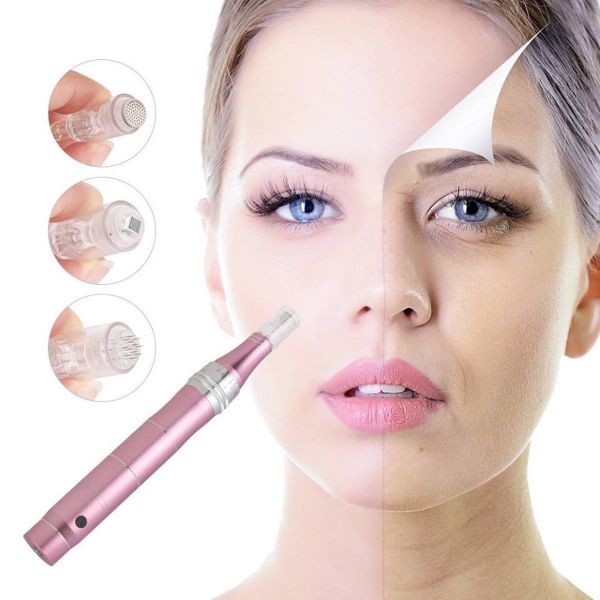 À Lagny-sur-Marne | Formation microneedling | Les meilleures esthéticiennes