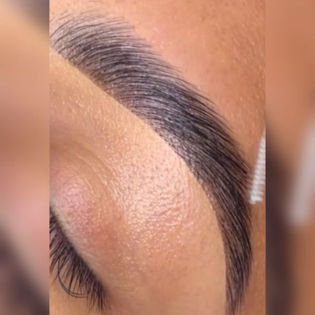 Brow lift (rehaussement de sourcils) à Chanteloup-les-Vignes (78) Par Saloua - Estheca