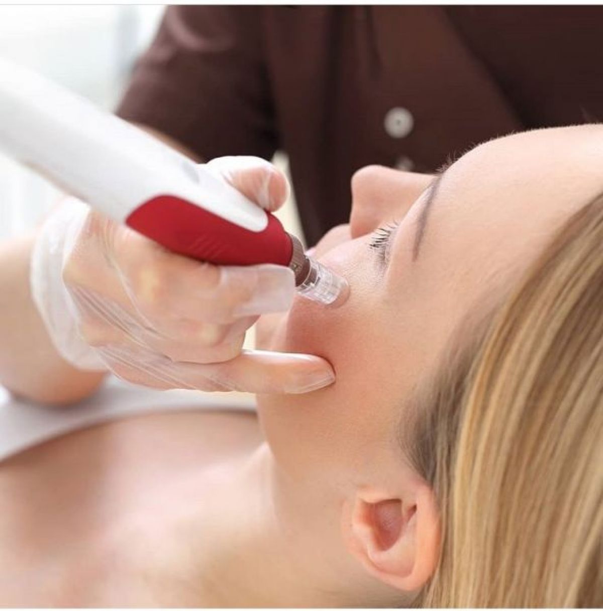 Microneedling/Peeling à Pessac (33) Par Racha - Estheca
