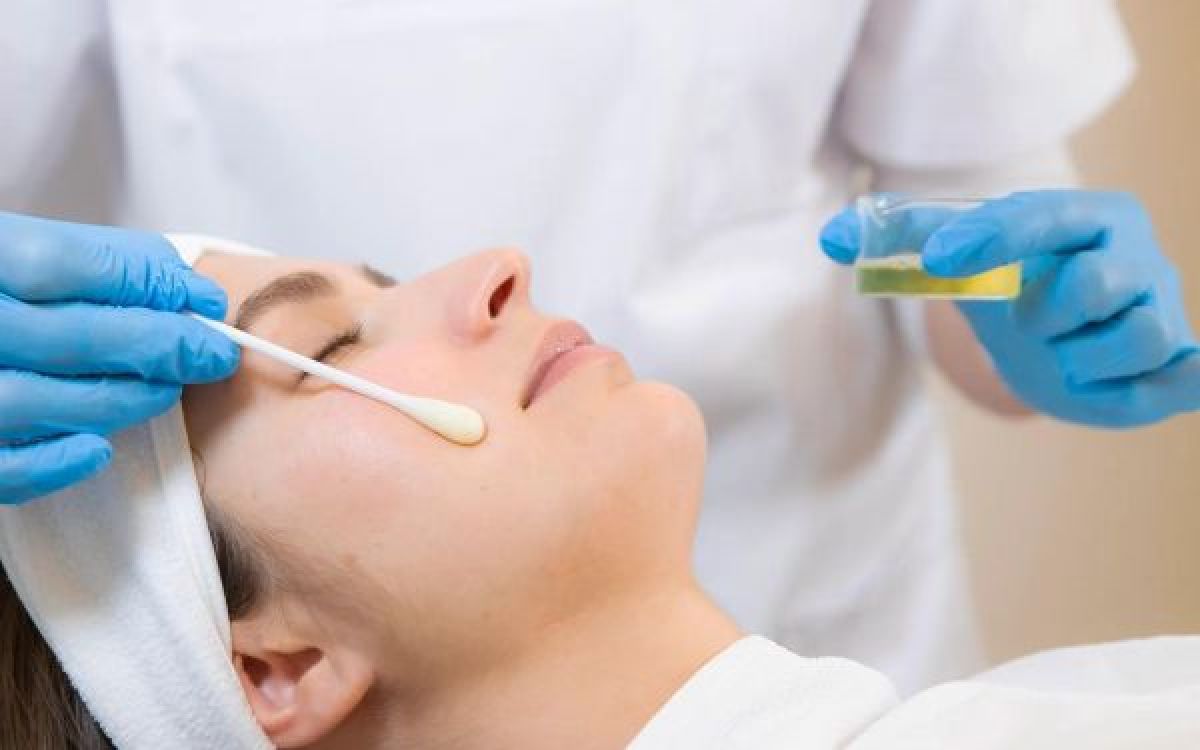 Peeling Tca nouvelle génération à Gagny (93) Par Basma - Estheca