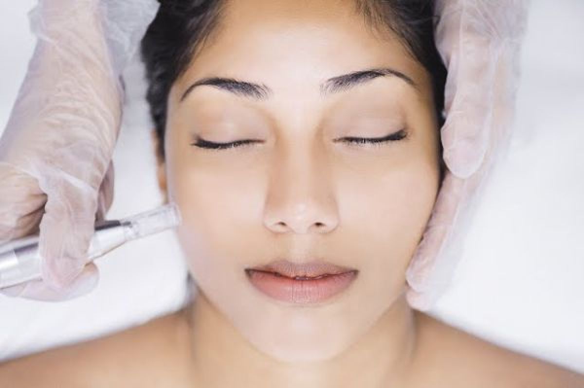 Microneedling BBglow à Rennes (35) Par Sabrina - Estheca