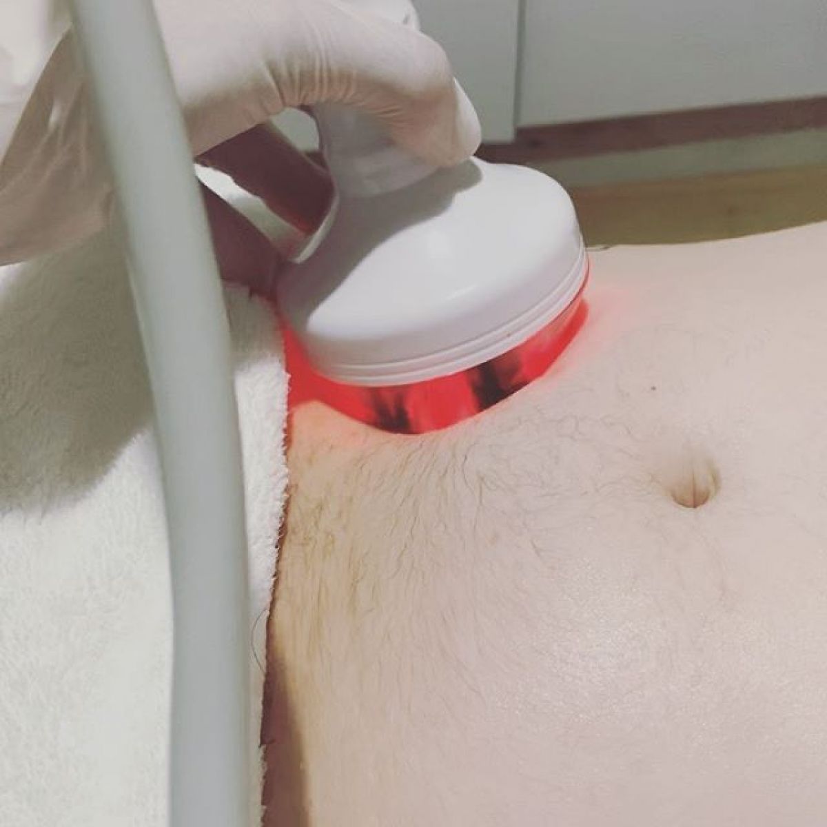 Radio fréquence et Lipocavitation à Créteil (94) Par Lucie - Estheca