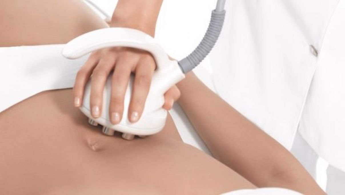 Radio fréquence - Lipocavitation à Saint-André-de-l'Eure (27) Par Caroline - Estheca